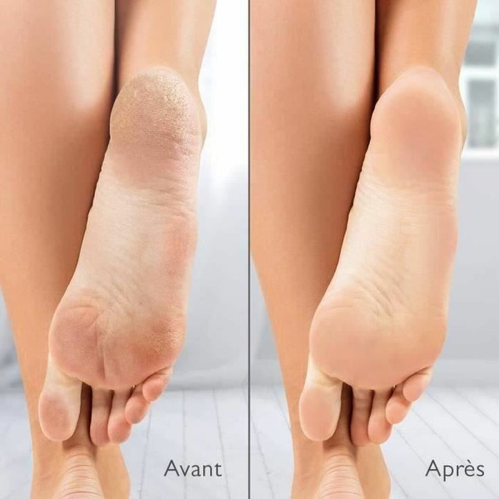 Electric Callus Remover Silk´n Vacupedi (5 Units)